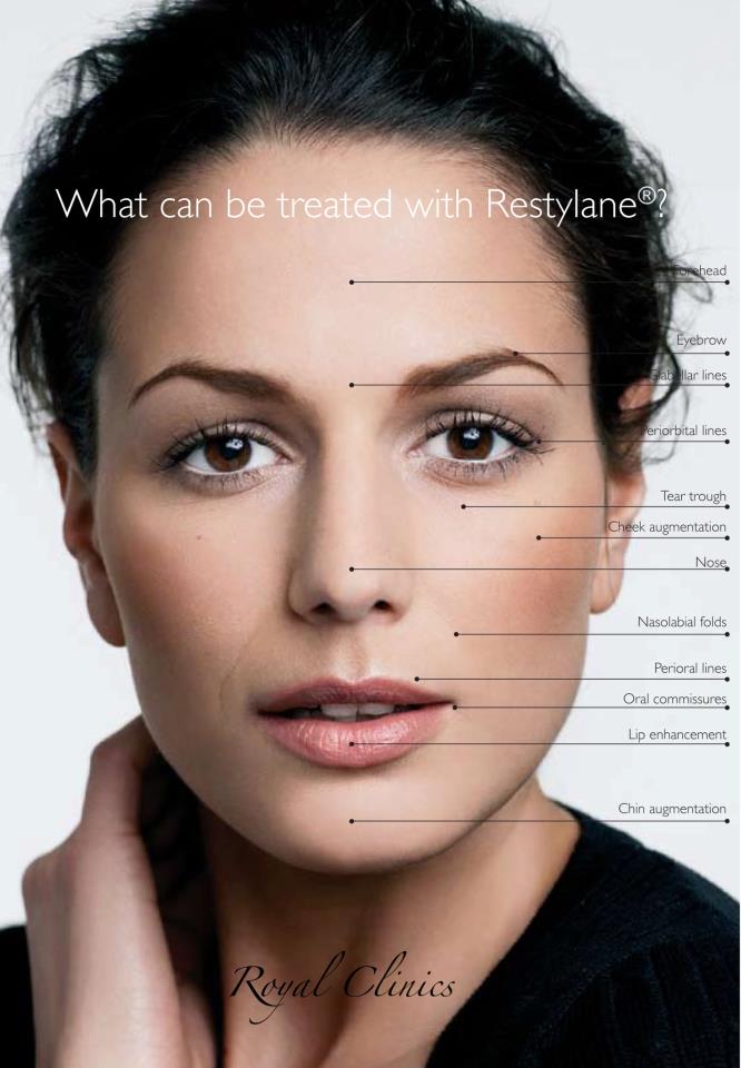 Restylane - ple